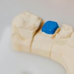 Dental Filling Leander